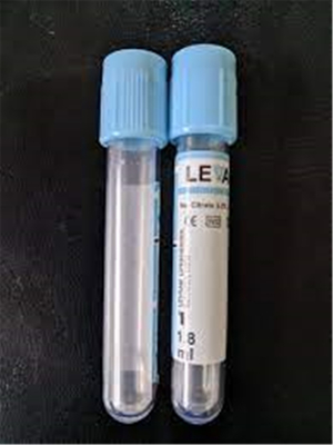 エチレンジアミン四酢酸の血液サンプルのコレクションのガラスびんによっては血塊の活性剤の管がゼリー状になる