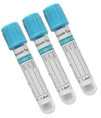 青い上のSstの実験室試験の血清のゲルの管のエチレンジアミン四酢酸のガラスびんEOSの消毒